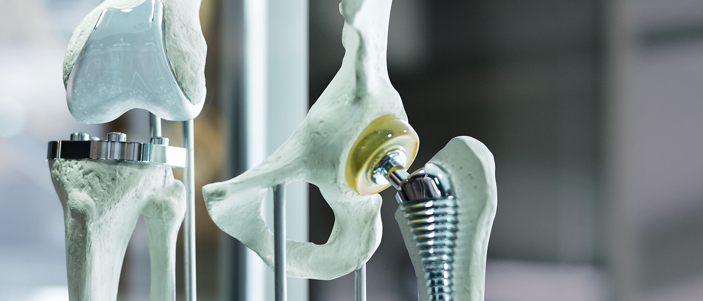 Orthopedic Implant: Which New Technologies are Maximizing Growth Prospects?
